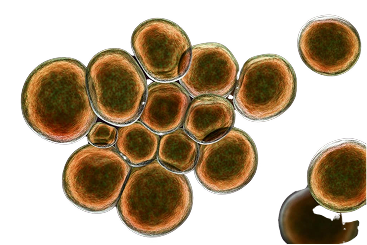 Ureaplasma urealyticum
